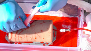 Krwotok - Pierwsza Pomoc